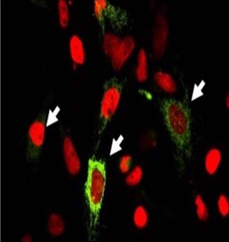 Protocole pour sélectionner des anticorps qui dégradent leur antigène dans les cellules.