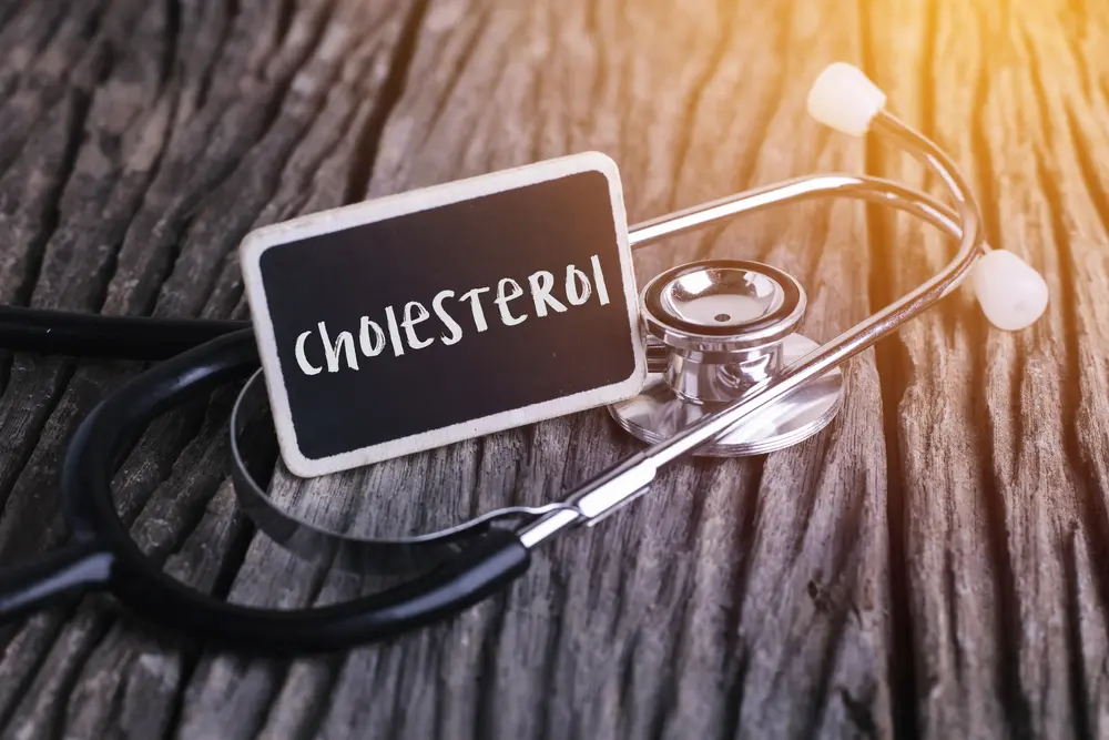 Cholesterol is involved in ageing processes