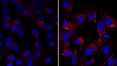 La dendrogénine A reprogramme les cellules tumorales qui sécrètent des exosomes qui activent le système immunitaire contre la tumeur