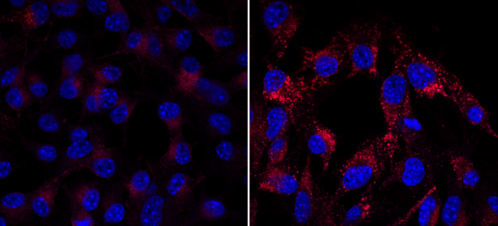 La dendrogénine A reprogramme les cellules tumorales qui sécrètent des exosomes qui activent le système immunitaire contre la tumeur