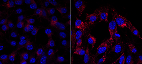 Dendrogenin A reprograms tumor cells to secrete exosomes which activate the immune system against cancer