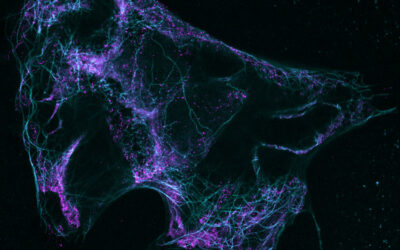 Workshop : Multiscale Fluorescence Imaging: from molecules to tissues
