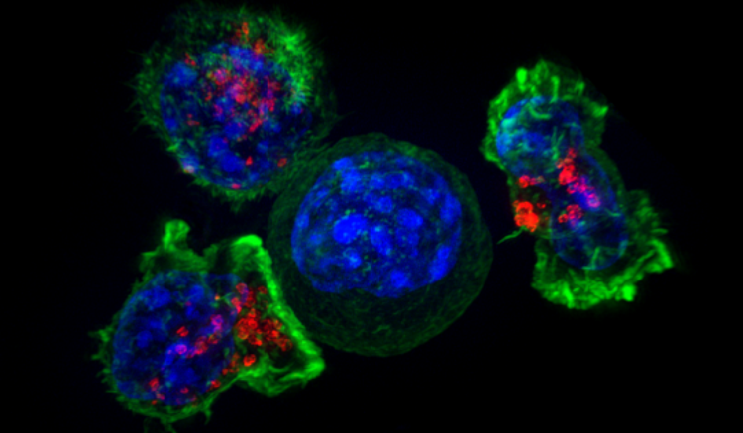 Résister à l’attaque des lymphocytes T : mécanismes de défense et de réparation intrinsèques aux cellules tumorales