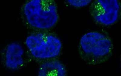L’autophagie contribue à la résistance au Ruxolitinib dans les néoplasies myéloprolifératives