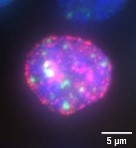 La cytidine désaminase protège les cellules cancéreuses des médicaments ciblant l’ADN.