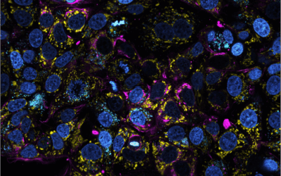 ESPRESSO : omiques spatio-temporelles basées sur le phénotypage des organites