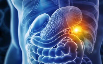 Improving the classification of pancreatic cancer: identification of a tumor subtype that is metabolically dependent on its environment
